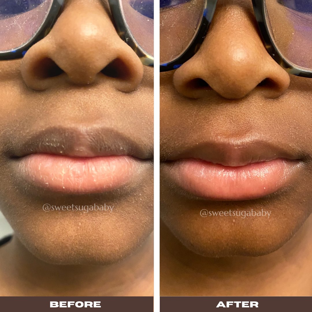 1sweetsugababy's tweet photo. When’s the last time you exfoliated your lips?
Exfoliating your lips with Soft &amp; Bright Suga Lip Scrub softens, brightens, and moisturizes your lips.

https://t.co/JmnAiwvkQ0 https://t.co/kWgSPX8nQa