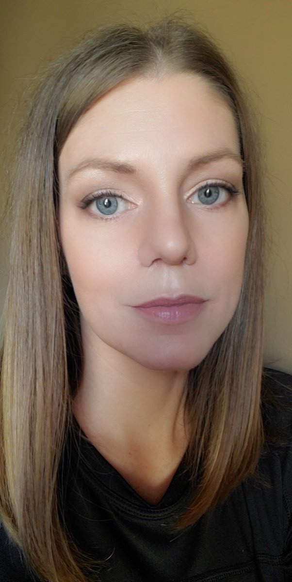 bsyoung3813's tweet photo. When your new nose starts taking shape 5 weeks post-op ❤️ https://t.co/ZIuHwiHaW5