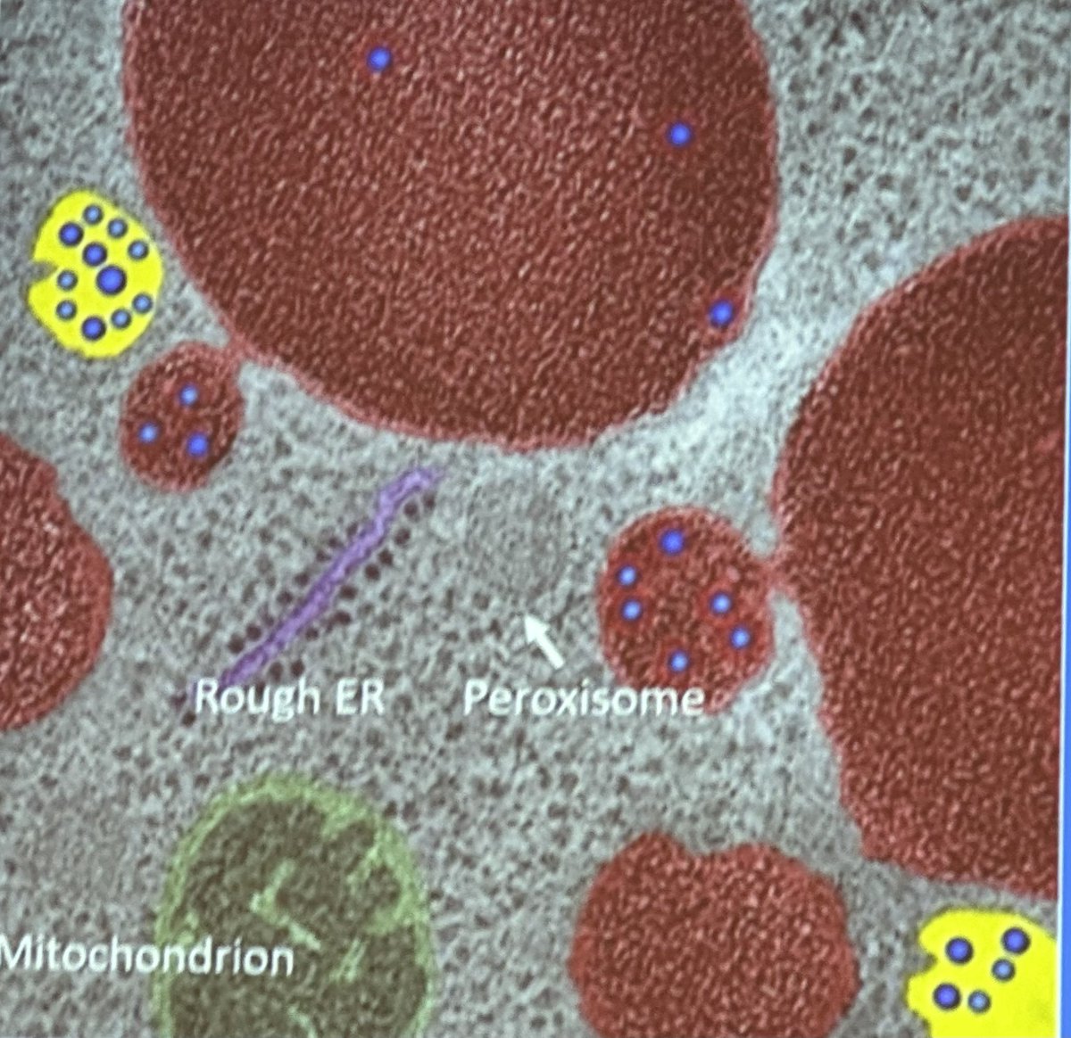 sgpombe's tweet photo. Thanks Daniel Nickerson @csusb_biology for sharing this lovely yeast micrograph to introduce how you’re sussing out the mysteries of the #Rab #GAP #Gyp8- Where is it? What does it do? #CSUPERB https://t.co/Mi5vZQcx1g