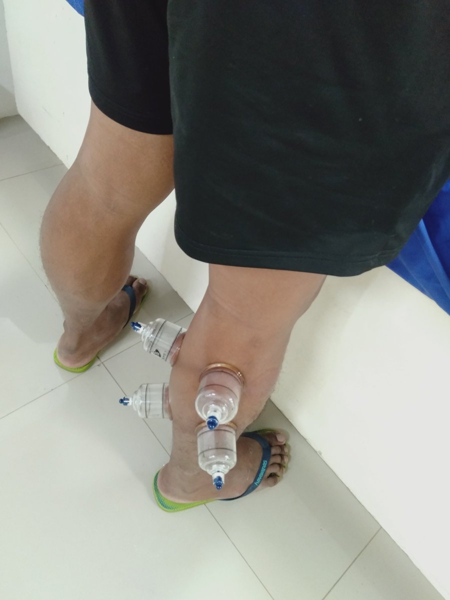 s_nituda's tweet photo. Over Strech Ligaments Agaaay!! 

aw anad na masakitan basic nalang hahaha Bunaaal Gihapon haha https://t.co/E2BzjRP7Ku