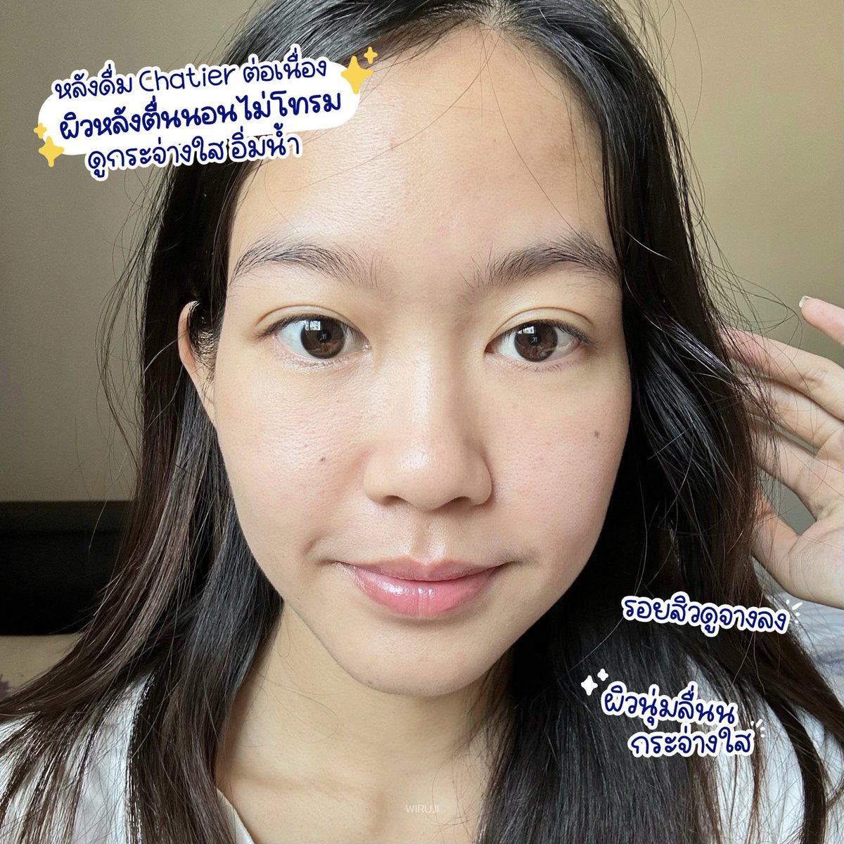 wiruji's tweet photo. ทุกคนรู้ว่านี่นอนน้อย🥹 โทรมจริงไม่จกตา5555 แต่ #Chatier หรือว่าคอลลาเจนน้องฉัตรตัวนี้คือช่วยได้นะ ละอร่อยย ที่หลายๆคนบอกว่ากินง่าย เออง่ายจริง ไม่คาวเลย นี่ชงกินแทนน้ำหวาน อร่อยมั่กก แต่ไม่มีน้ำตาล👍🏻 ชงกินต่อเนื่อง รู้สึกว่า ตื่นมาแล้วผิวไม่โทรมมาก อิ่มน้ำดีจริงง https://t.co/03riRyZual