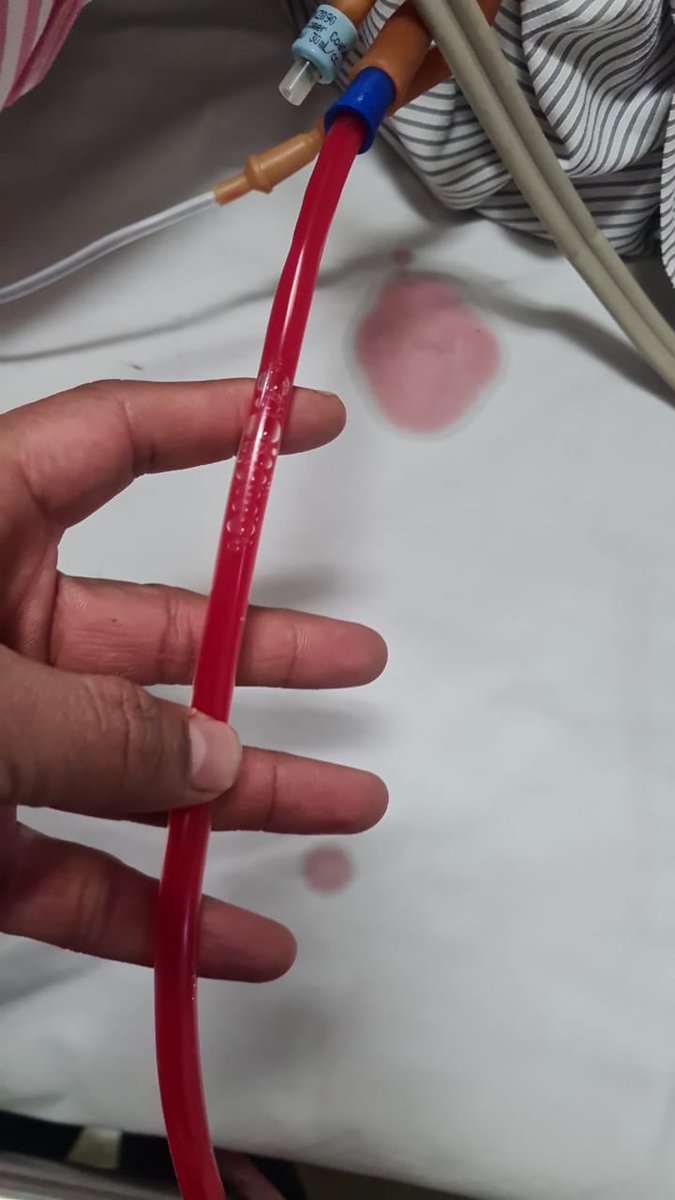 DR PUNIT BANSAL tweet media