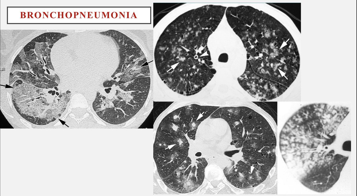 Dr Khaled Ahmed Abuzeid on Twitter: