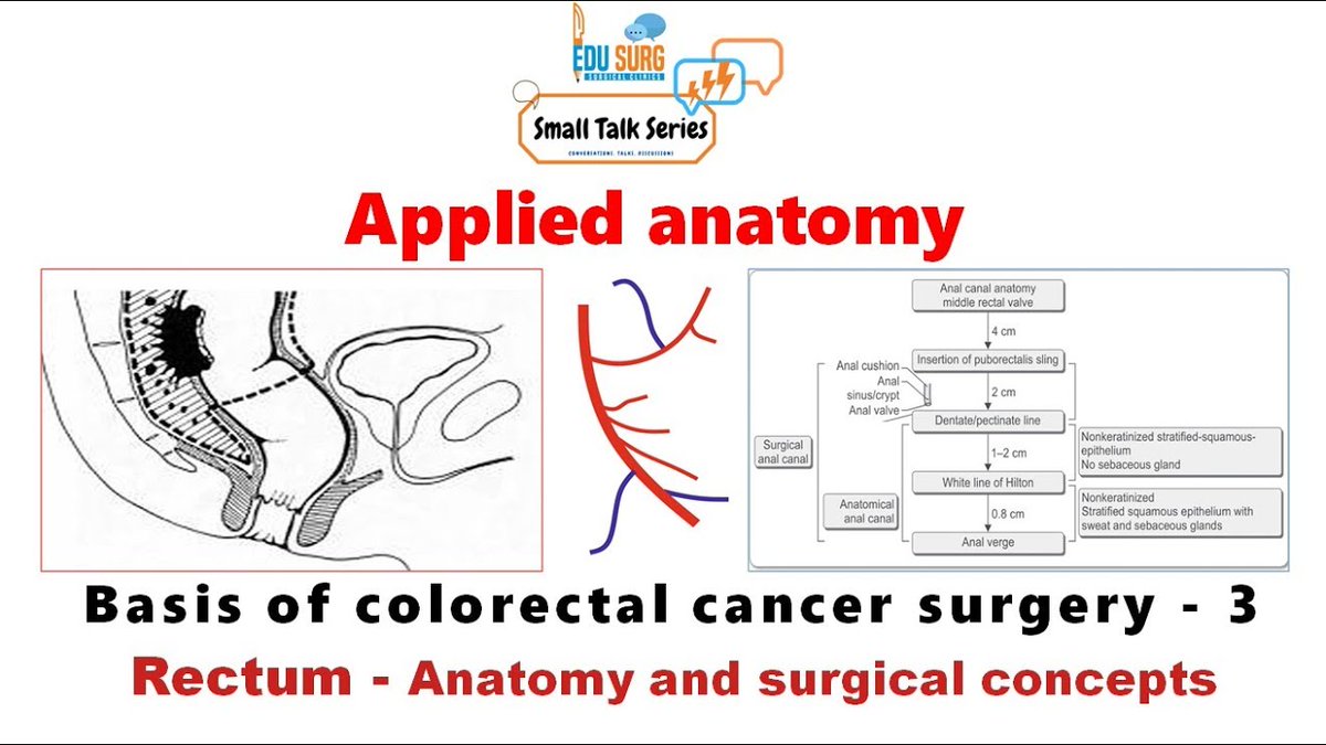 edusurg_clinics's tweet image. Applied Anatomy Of Rectum - Colon And Rectal Cancer Surgery - Anatomical Basis. Click here to watch the full: learnwithedusurg.in/applied-anatom… |  youtu.be/q3Zxlv_Gd2U

#RectumAnatomy #ColonCancer #RectalCancer #ColonCancersurgery #RectalCancerSurgery #Surgeon #Surgery #EduSurgClinics