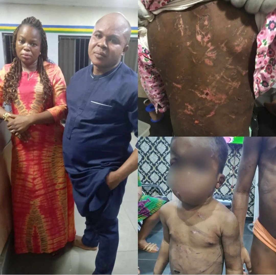 lifeissues_11's tweet photo. Lagos Police arrests husband and wife identified as Mr. Akebiara Emmanuel &amp; Mrs. Busola Oyediran for allegedly battering their two kids aged 5 and to coma following a report by their neighbour who rushed to battered kids to the hospital.

#NationalShutdown https://t.co/1FCccqnDb8