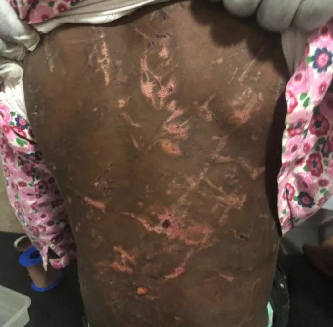 lifeissues_11's tweet photo. Lagos Police arrests husband and wife identified as Mr. Akebiara Emmanuel &amp; Mrs. Busola Oyediran for allegedly battering their two kids aged 5 and to coma following a report by their neighbour who rushed to battered kids to the hospital.

#NationalShutdown https://t.co/1FCccqnDb8