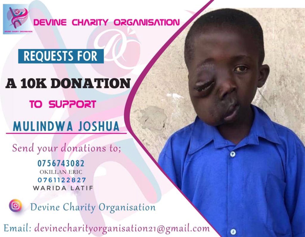 He needs to be operated as soon as possible.
A retweet is highly appreciated 🤝
