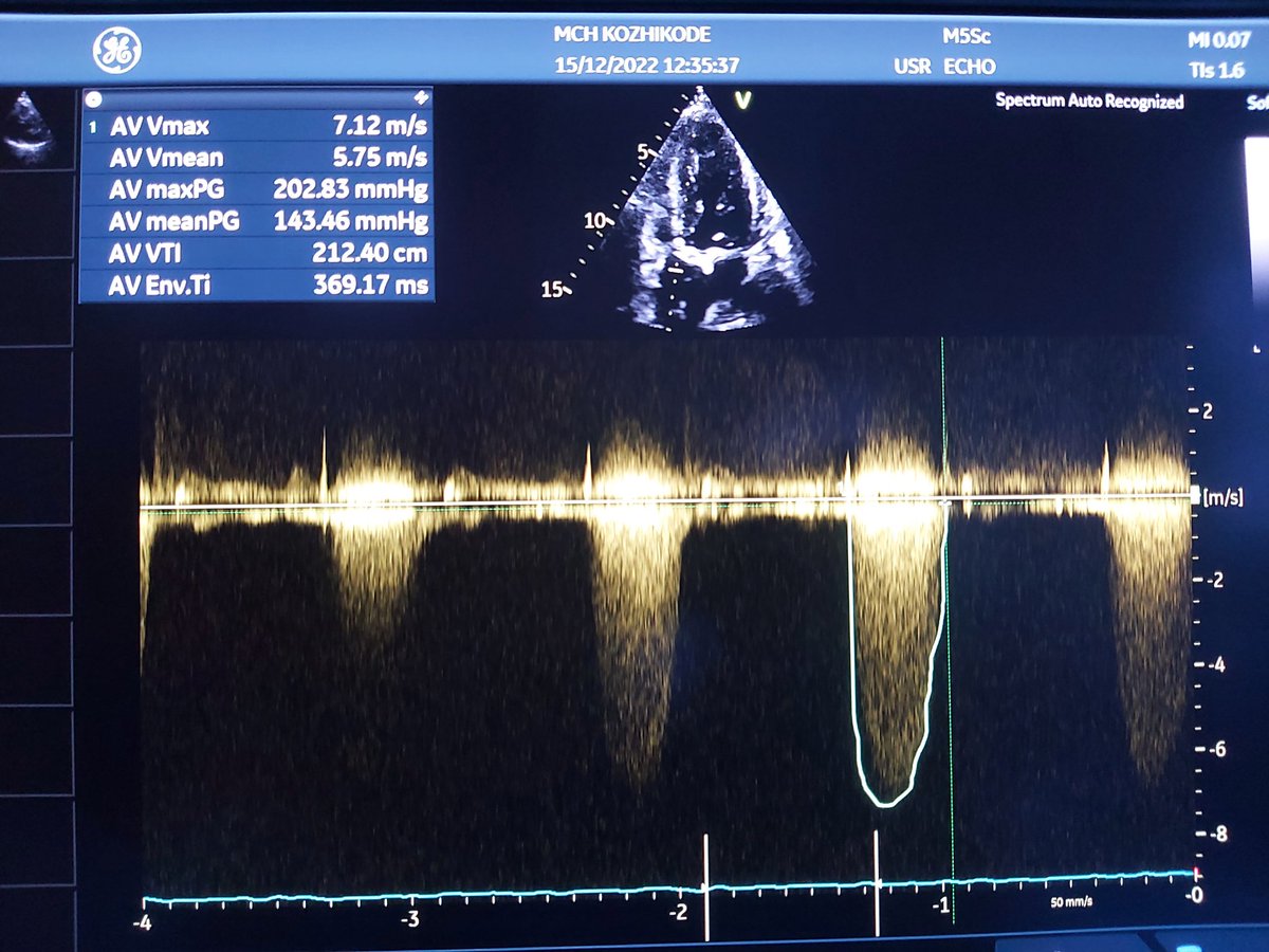 Muhammad Ameen tweet media