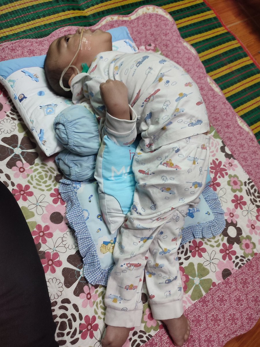 Tolong guys, anak buah aku bengkok terus badan keras dah semua otot. Ada sesiapa boleh rekemen kat mana tempat berubat. Please guys. Parents dia penat dah berubat kat hospital.