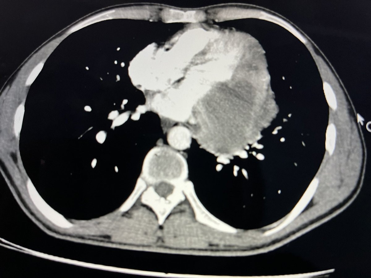 Cerrahpasa cardiology tweet media