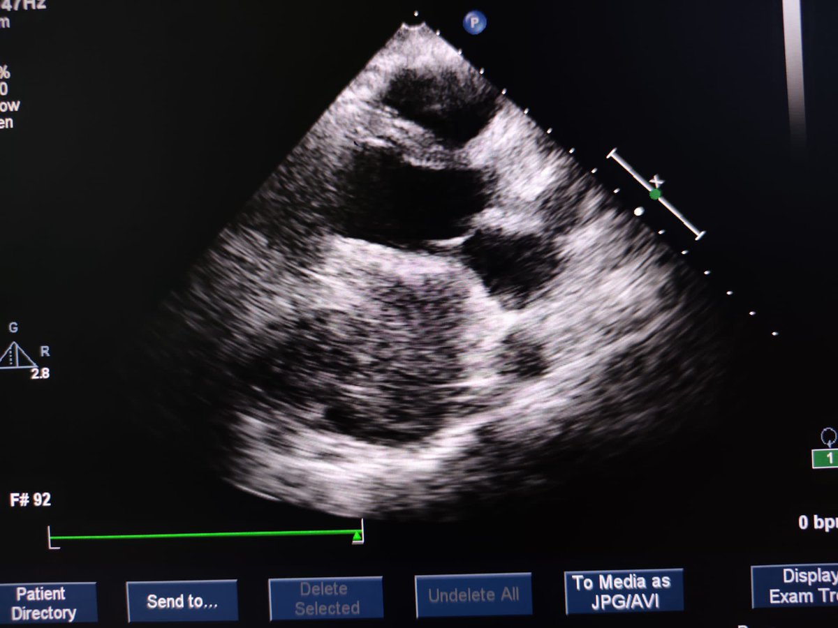 Cerrahpasa cardiology tweet media