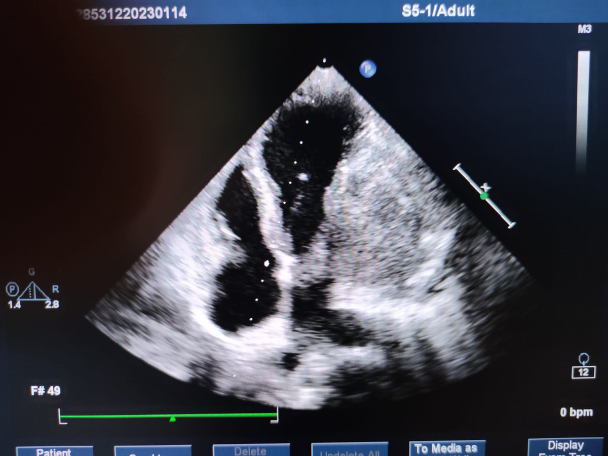 Cerrahpasa cardiology tweet media