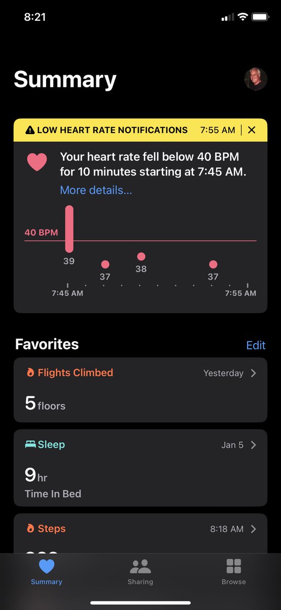#Apple #AppleWatch. Without my Apple Watch sending me alert on Monday. I might not be here right now.
