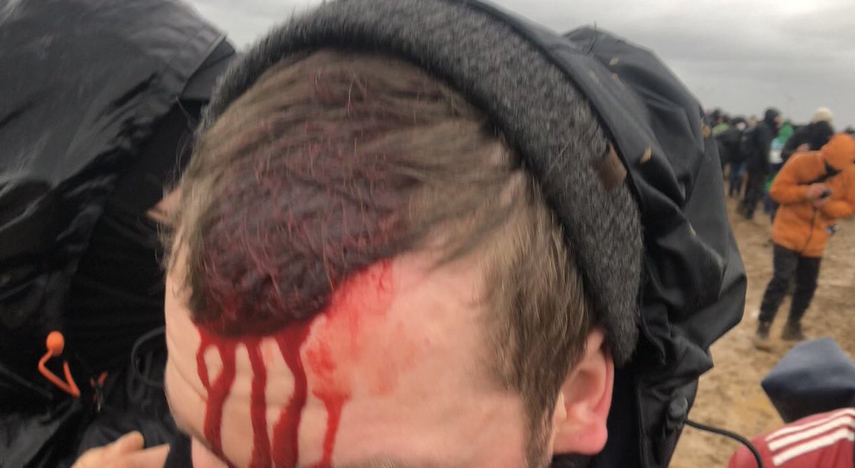 Ein Klimaschützer wurde von der Polizei mit dem Schlagstock an der Stirn getroffen. 

#Luetzerath