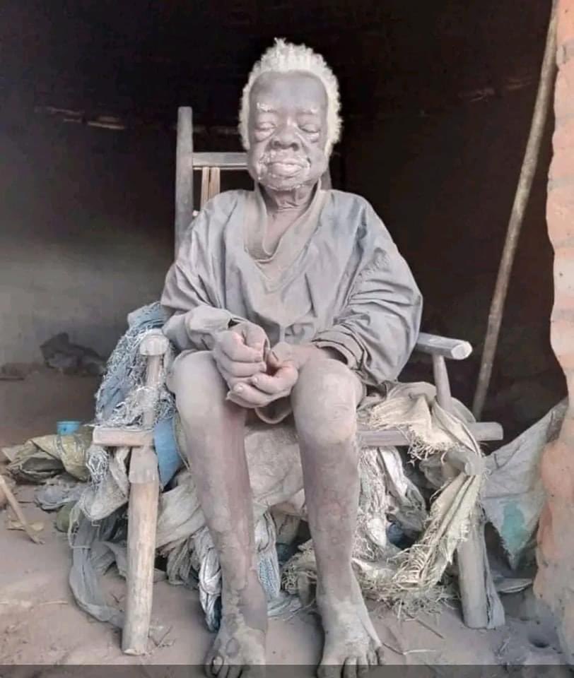 leParrainRDC's tweet photo. 🛑RDC: 146 ans à ce jour, il se nomme Aubabe GIRIDUBHO MOROO, le congolais le plus âgé. 

Il est né en 1877 dans le village de #Nderi en territoire d'ARU dans la province de l'Ituri. https://t.co/MrtBiypgWy
