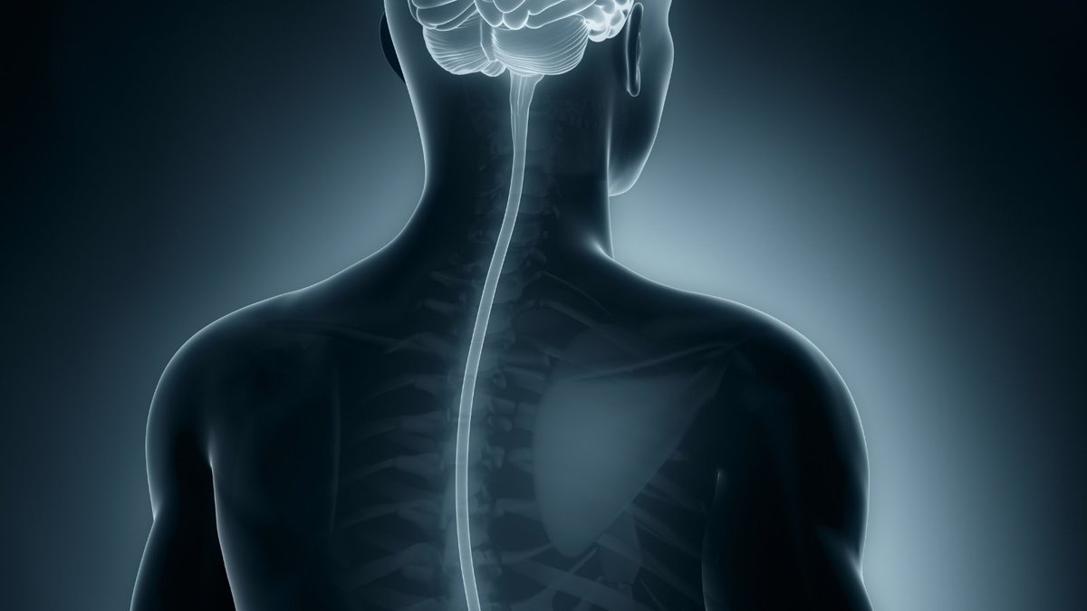 ECTRIMS's tweet photo. #MSJournal: Research by @BarakMuhamed @lester_melie @JensKuhle @ThINk_Basel et al from @UniBasel investigates the extent, pattern, and clinical relevance of spinal cord grey and white matter atrophy in #MS patients @MSJ_Research
https://t.co/297cdKFkSM https://t.co/dcSJALovdG