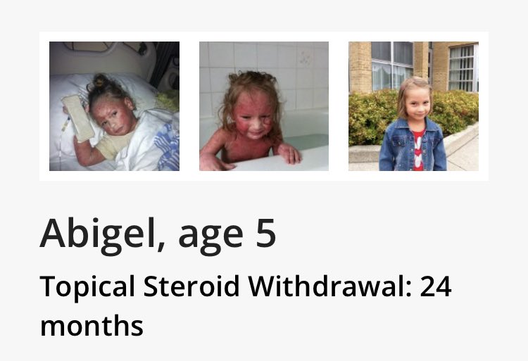 topicaldebate's tweet photo. @DrSyedHaider “It’s a risk factor but all risks can be mitigated.Any harm can be healed.”
Really? Your talking #GreasyDrugRepLies.
This⬇️is caused by #drs #RecoveryTime 3.5 -14 years plus #IntolerableSuffering #Trauma #mentalhealth #StopLying #BigPharmaDeceit #Thalidomide #Mesh #Talcum #PSSD https://t.co/ANP8kaKKOQ