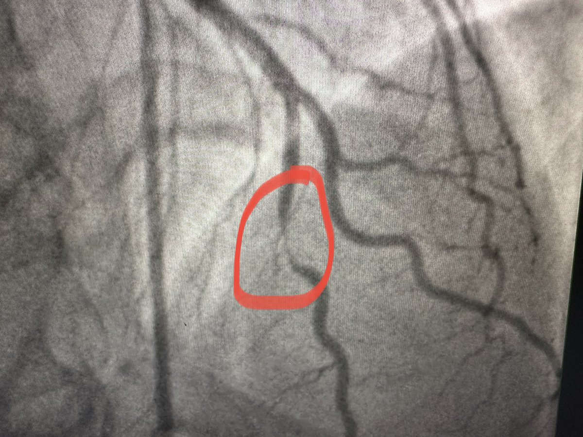 Craig M. Wax D.O. on Twitter: