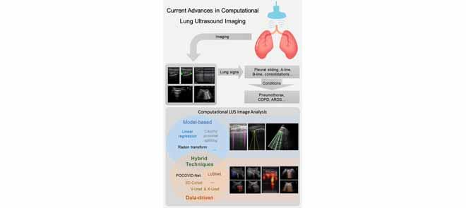 Alin Achim (@bramachim) on Twitter photo Just over 5 years since publishing the first ever journal article on lung ultrasound image analysis, we have assembled over 80 subsequent publications on the topic in a review paper just published:
ieeexplore.ieee.org/document/99459…
<a href="/KarakusOktay/">Oktay KarakuĹź</a> <a href="/puinantheera/">pui nantheera</a> <a href="/VILaboratory/">VILaboratory</a> @BristolUniEng Just over 5 years since publishing the first ever journal article on lung ultrasound image analysis, we have assembled over 80 subsequent publications on the topic in a review paper just published:
ieeexplore.ieee.org/document/99459…
<a href="/KarakusOktay/">Oktay KarakuĹź</a> <a href="/puinantheera/">pui nantheera</a> <a href="/VILaboratory/">VILaboratory</a> @BristolUniEng