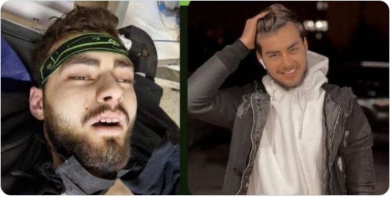 Anahita (@anahita_babaei) on Twitter photo #HamidrezaRouhi . First they shot him in the chest, then they stole the body and put the costume of Basiji (volunteer for Khameneyi) on him. What a sick psychopaths you are #IRGCterrorists
#مهسا_امینی #HamidrezaRouhi . First they shot him in the chest, then they stole the body and put the costume of Basiji (volunteer for Khameneyi) on him. What a sick psychopaths you are #IRGCterrorists
#مهسا_امینی