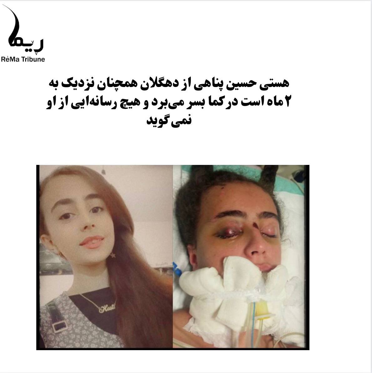 AbTarza's tweet photo. #هستی_حسین_پناهی از دهگلان همچنان نزدیک بە ٢ماە است در کما بسر می‌برد.

#ژینا_امینی
 #مهسا_امینی
#ژن_ژیان_ئازادی 
  #irgcterrorists https://t.co/VlvTwfjzBF