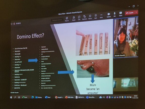 Martinfox2000's tweet image. @Howarth2L .. thank you for sharing your Mum’s #PAD &amp;amp; life story .. really resonates with the reality of a huge number of people I see, living .. and dying early.. with #PAD I hope this event catalyses us in Gtr Manchester to learn how to engage better with the 70% #missingness