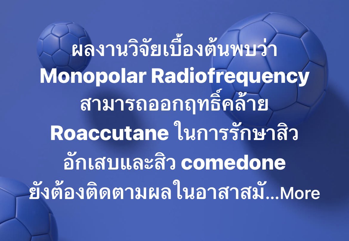 DrWoraphong's tweet image. ผลงานวิจัยเบื้องต้นพบว่า Monopolar Radiofrequency สามารถออกฤทธิ์คล้าย Roaccutane ในการรักษาสิวอักเสบและสิว comedone
ยังต้องติดตามผลในอาสาสมัครทุกคนจนถึง 6 เดือนหลังการรักษา
#monopolarrf
#inflammatoryacne
#isotretinoin