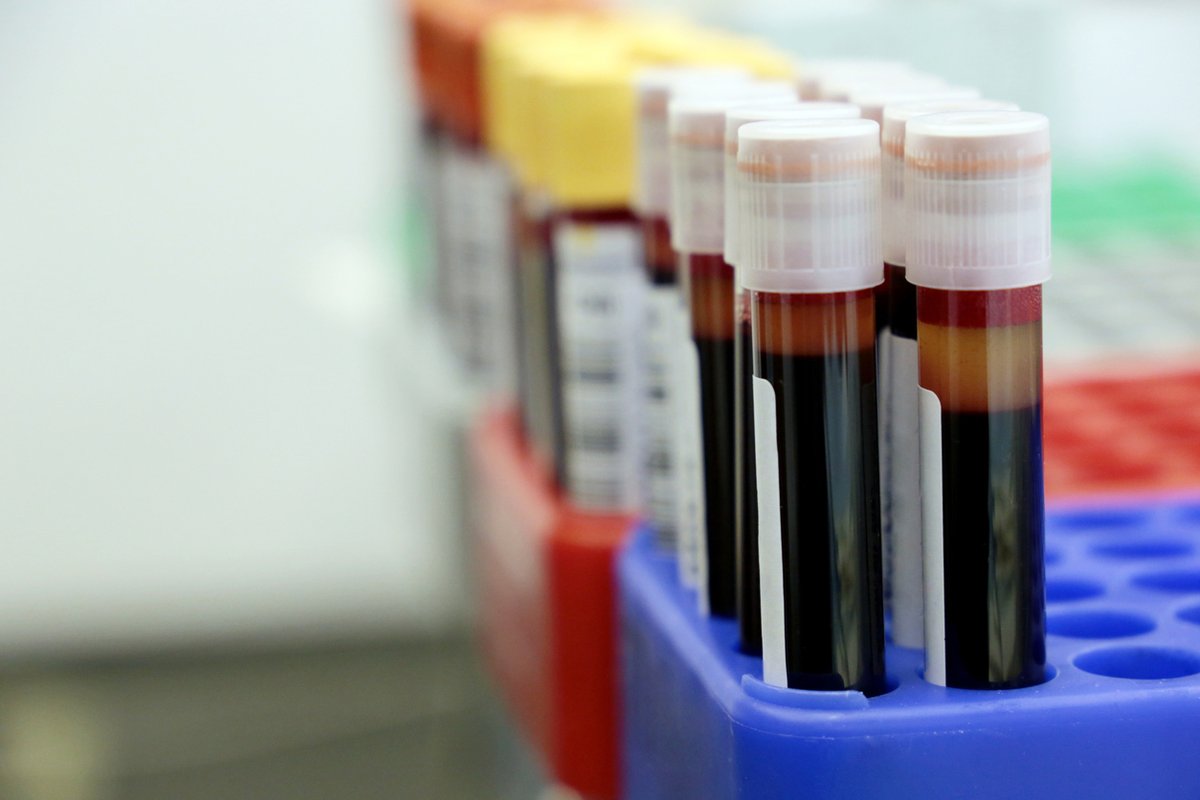 PsychiatricNews's tweet photo. ETHICS CORNER | Involuntary Psychotropic Medication Treatment and Blood Tests
Potential risk of serious and life-threatening side effects from antipsychotic medications mandates caution in their use and close monitoring for safety. https://t.co/dzH4sH1tLQ #PsycTwitter https://t.co/AfWoSQRLJB