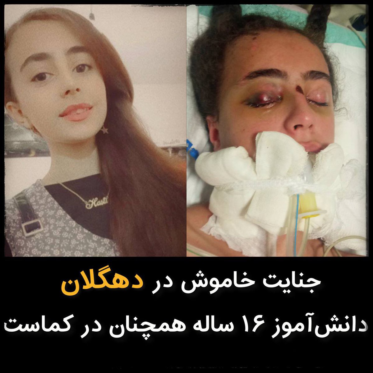 golden_dragon76's tweet image. #Hesti_Hussein_Panahi, a 16-year-old student from a village near Dehgolan, has been in a coma for nearly 2 months now. Hesti participated in protests both in school and outside. The day when the repressors wanted to stop his 1/3👇
#Hesti_Hussein_Panahi
#IRGCterrorists