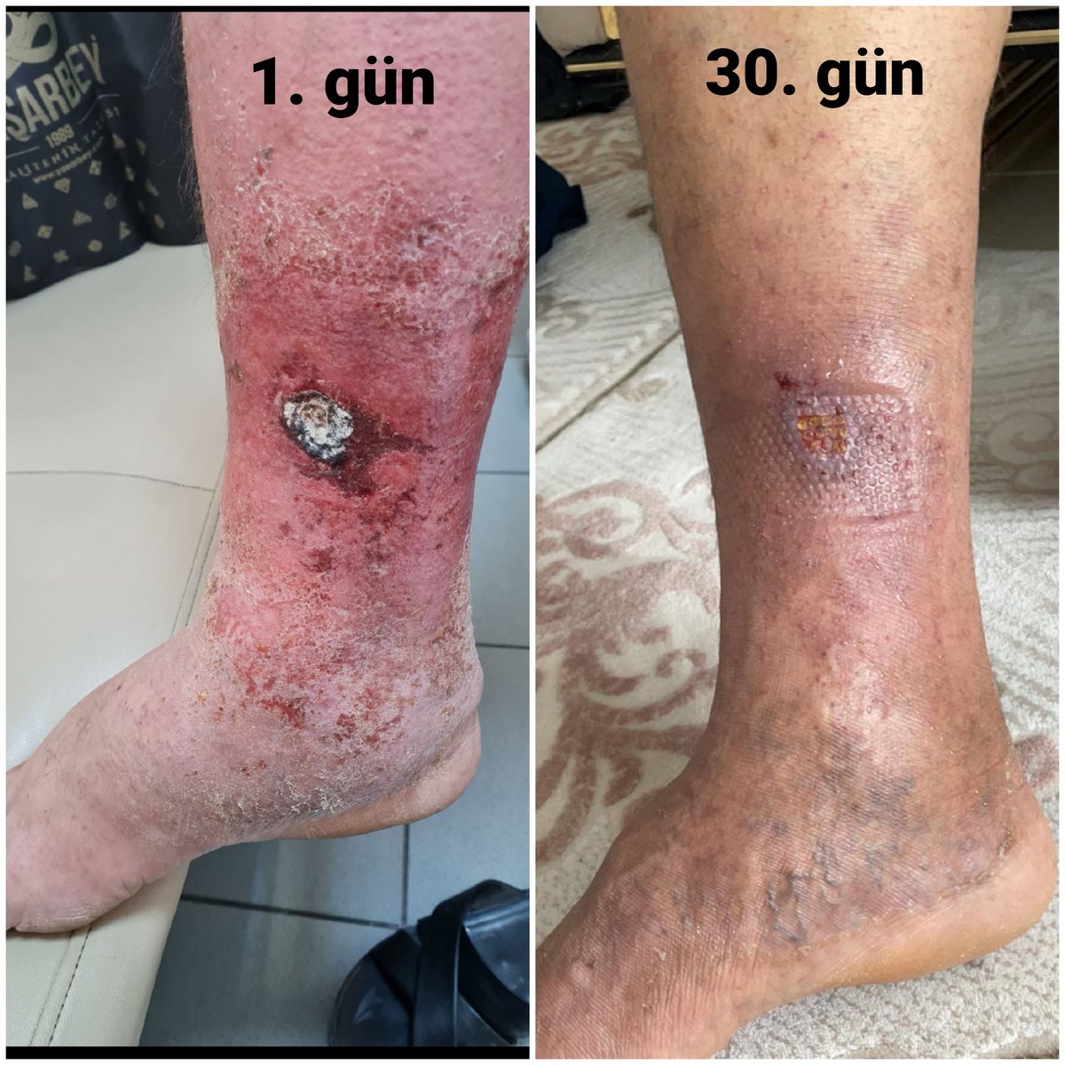 Varis, ihmale gelmez.
Yara bakımı sanattır.