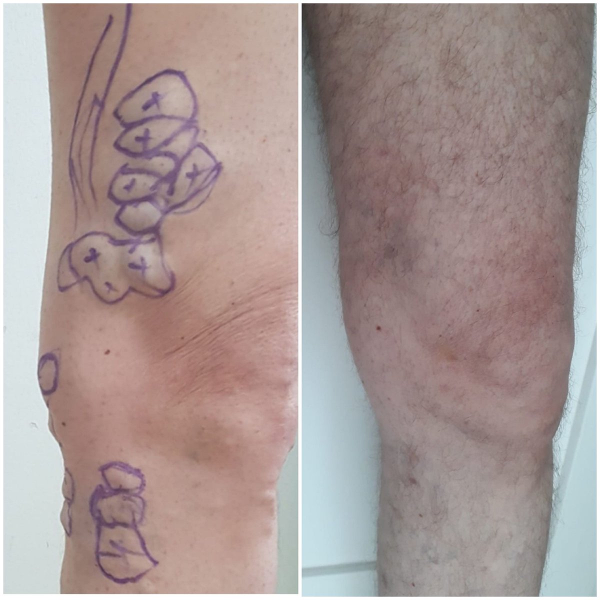 Varis, ihmale gelmez. Kozmetik bir sorun da olabilir.
Konforu bozan herşey hastalıktır.