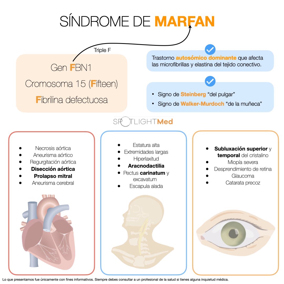 Síndrome de Marfan 🧬🤓 #spotlightmed #medschool #medstudent #SpotlightMedicine #genetica #geneticahumana #genetics #humangenetics #mip #mpss #enarm #enarm2023 #medstudentlife #sindromedemarfan #marfansyndrome