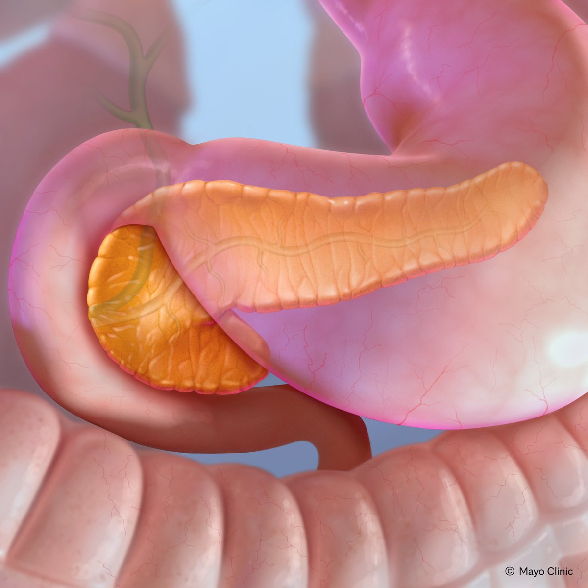 Vinay Chandrasekhara, MD tweet media