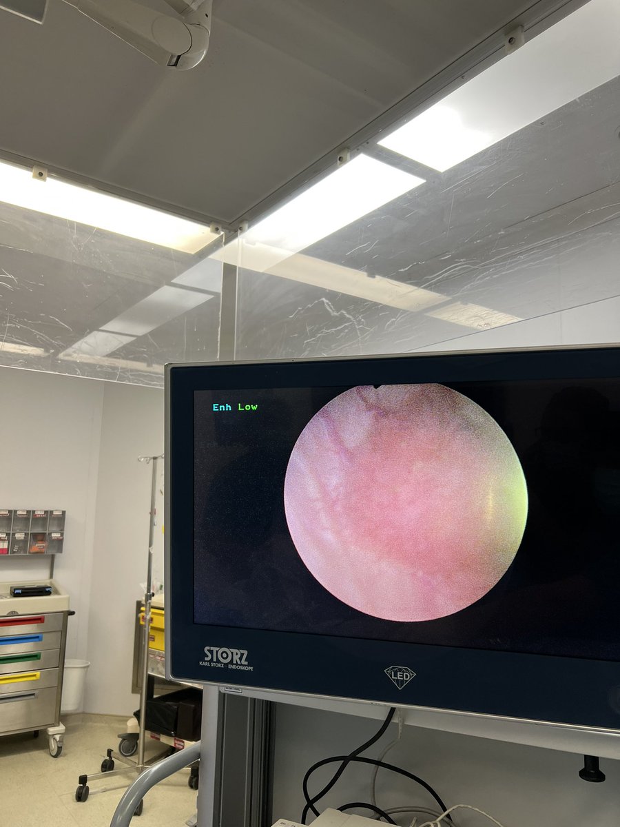 estkorgali's tweet photo. en bloc resection of bladder tumor 👌🏻 #enblocresection #bladdercancer https://t.co/qmMrUGIsDq
