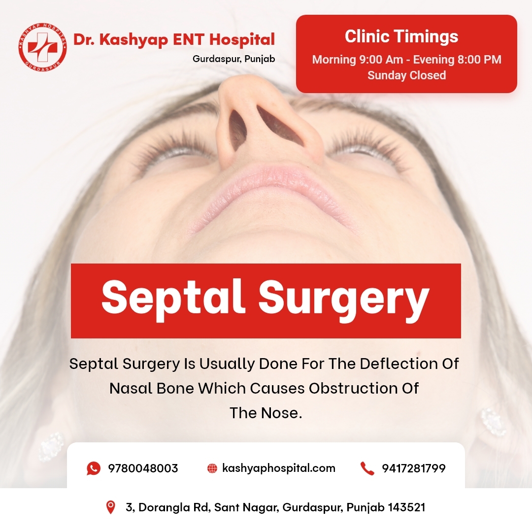 #SeptalSurgery is usually done for the deflection of nasal bone which causes obstruction of the nose.👃🏻🩺
#kashyapent #septalsurgery #BestENTHospital #entdoctor #Gurdaspur #healthcare #GurdaspurNews #gurdaspurhospital #mastoid #surgeon #surgery #medicine #diagnosis #hearingaids