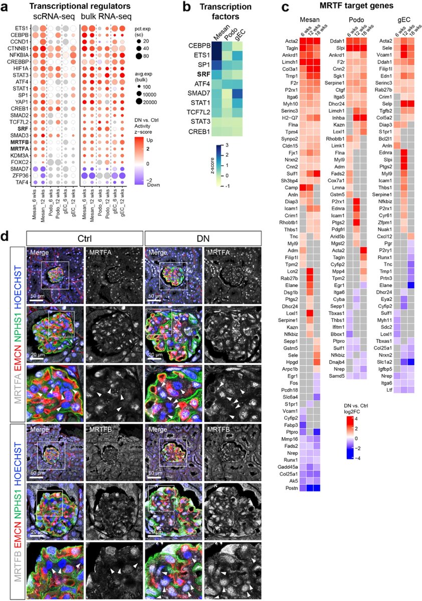 BiomageLtd's tweet photo. Researchers profile renal cells from type 2 diabetes mice at the early stage of diabetic #nephropathy.
https://t.co/NF73lhQUT1
They reveal activation of the mechanosensitive signaling pathway MRTF-SRF in response to glomerular hyperfiltration ex vivo.
#scRNAseq #bulkRNAseq https://t.co/rlyQQRi2cv