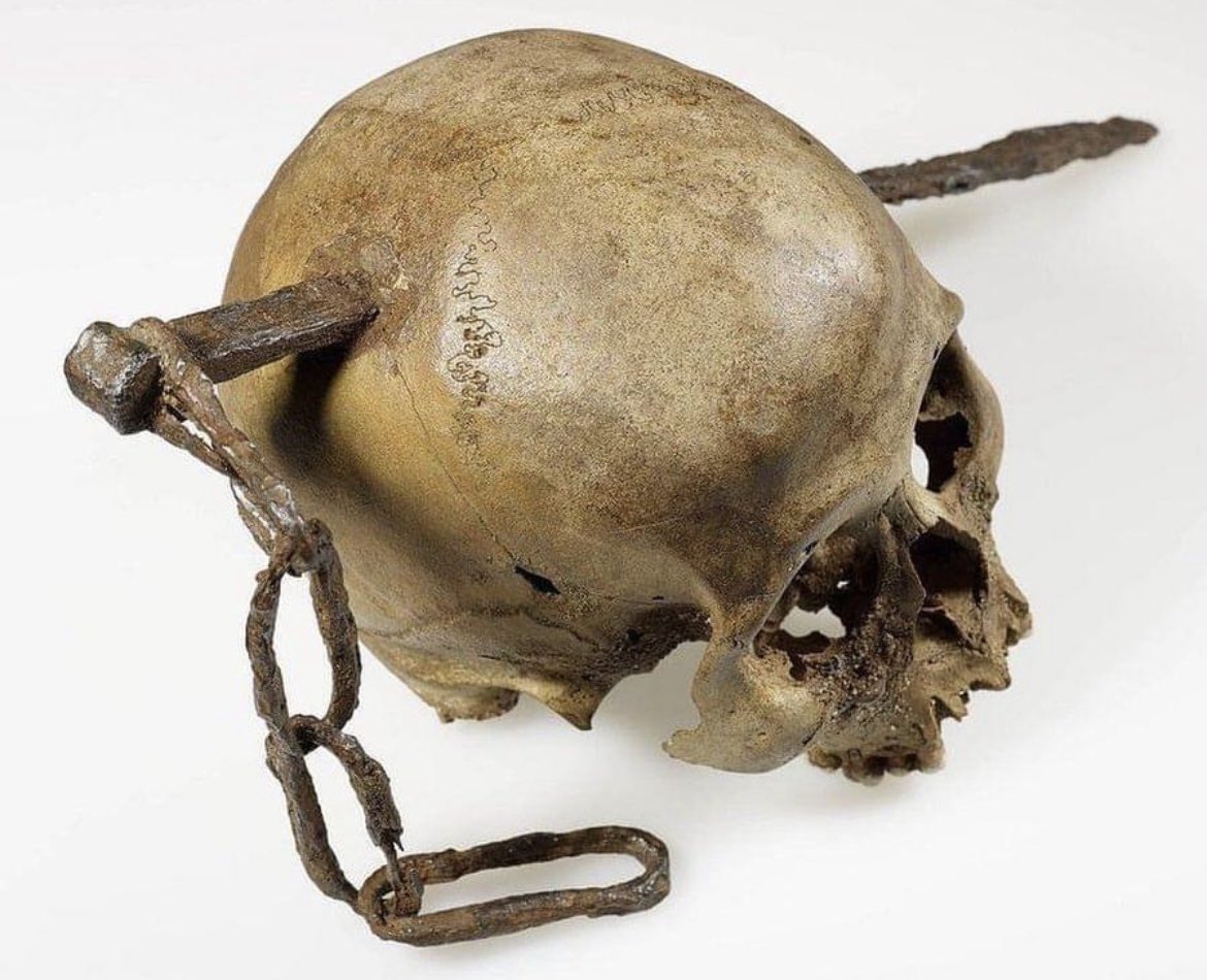 A Roman era skull found impaled with a large spike. It is currently on display in Bonn, Germany.