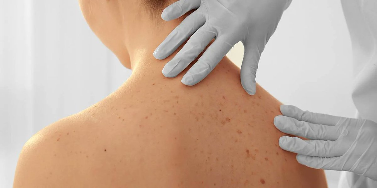 TheDermatologyCentre tweet media