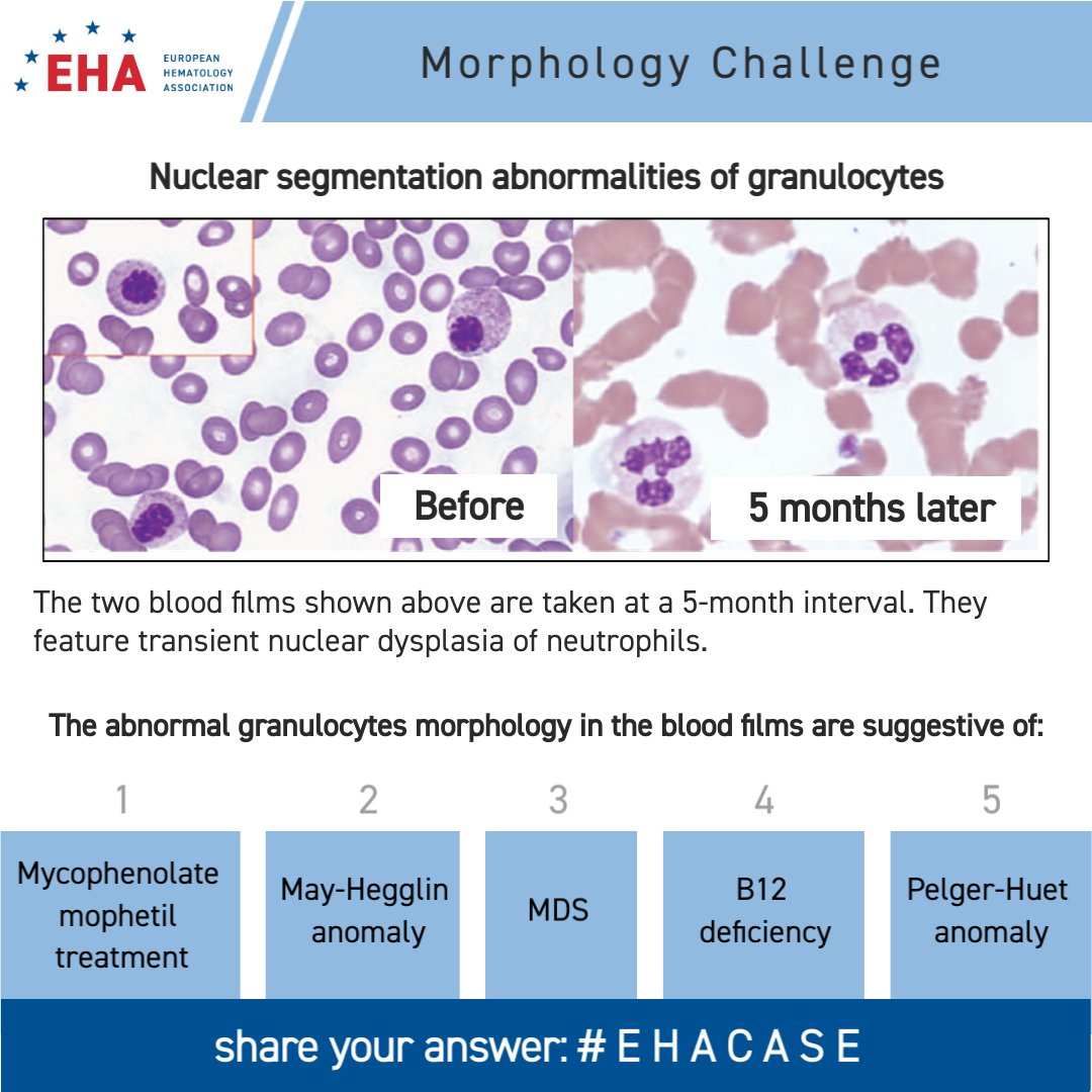 Happy New Year and welcome to the first #EHAcase morphology challenge of 2023. Please take a look at the image below and answer the question given. 

Stay tuned and we will return later today with the correct answer. See you later!