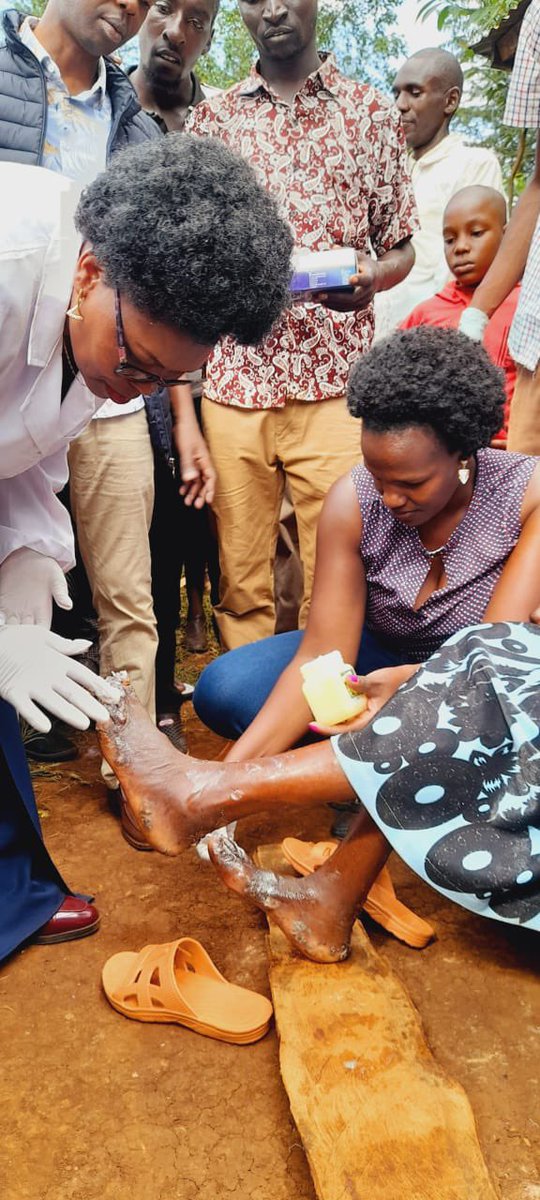 I learnt of Mama Rachel Chepkwony's plight, that of jigger infestation and  later sent my team for a fact finding mission. 
The findings broke my heart. The  intensity of the damage is worrying. 
Today, in the company of Hon Haron Rotich,Area MCA ,Hon Irene Chebet nominated MCA,