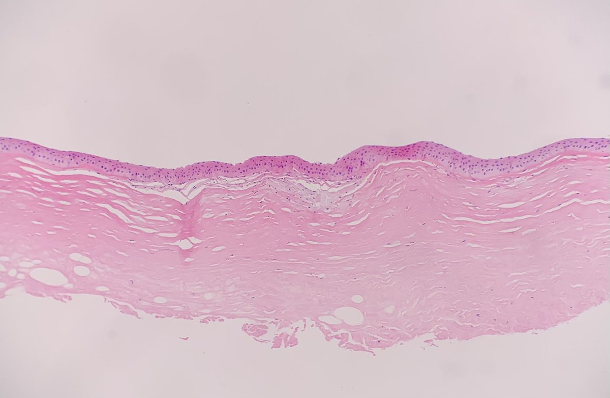AMColinoG's tweet image. Cornea #TwitterPath #EyePath