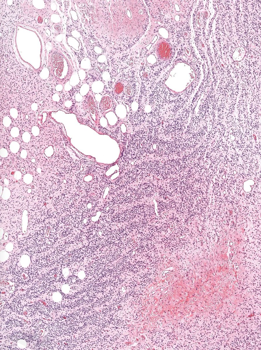 JMGardnerMD tweet picture