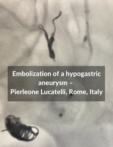 GuerbetGroup's tweet photo. 👨‍⚕️📷 When you think of your work, which picture do you have in mind?

That's the question we asked some interventional radiologists at #WithoutAScalpelDay!

Thank you to Marco Fronda @PLucatelli @VaniaTacher @interadiologist for sharing these pictures!

#WASD2023 #iRad https://t.co/J4fNc5VlRp