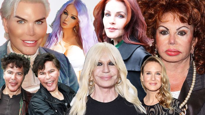 Wat vinden al die mensen toch aan het verbouwen van hun gezicht. Echt bestaan er mensen die dit echt mooi vinden? #botox