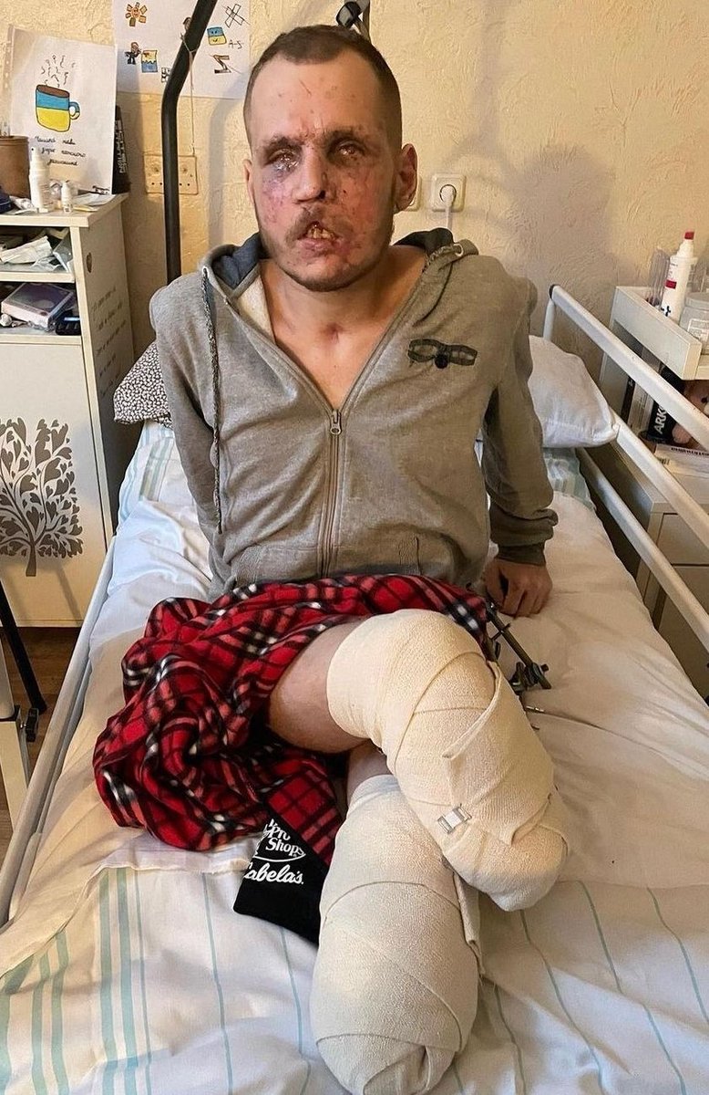 This is Serhiy Raylyan, call-sign Raven. He has been defending Ukraine on the frontlines since the beginning. He was injured on November 30th, resulting in a 2-week coma &amp; multiple traumas

Please consider supporting this hero’s recovery &amp; family

PayPal: annet1889@gmail.com