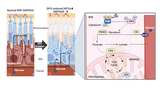 EmboMolMed's tweet photo. Online today 👉#HIF2α activation and mitochondrial deficit due to #IronChelation cause #RetinalAtrophy 👁️

#RetinalPigmentEpithelium #Deferoxamine #αKetoglutarate

By S. Tsang &amp; colleagues @Columbia

🗞️#openaccess: https://t.co/DdN2ql0vZ8 https://t.co/UiPyHlHgiF