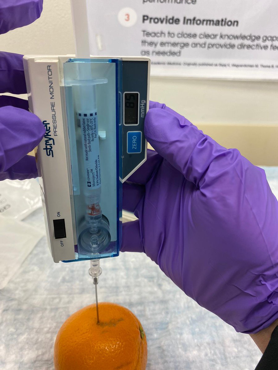 MSingh_MD's tweet photo. Kicking off 2023's Emergency Department #InSituSimulation @JacobiHosp with a case of tibial fractures requiring measurement of compartment pressures #DeltaPressure30 #Fasciotomy https://t.co/eZrLU2Ddih