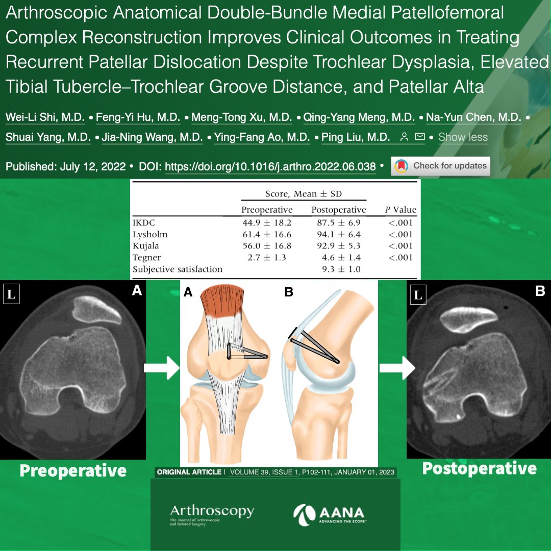 Trochlear Injection Trochlear Tubercle