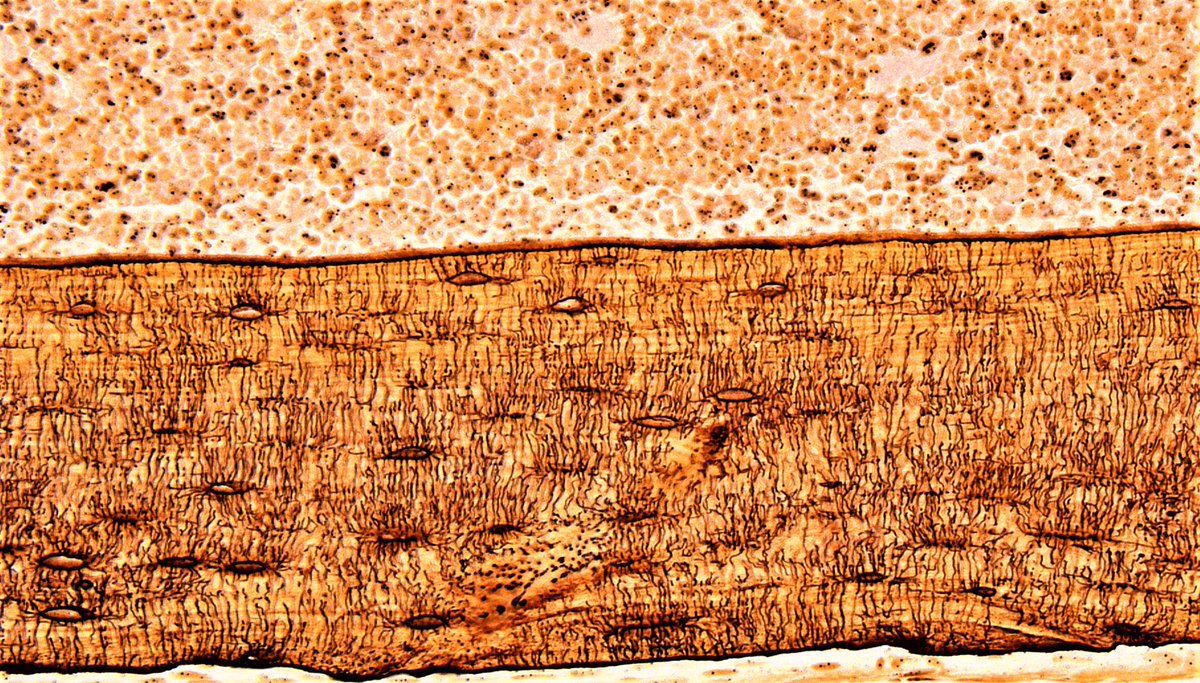 First time trying out silver nitrate staining! 🔬👩‍🔬🦴#microscopymonday #bone #osteocytes