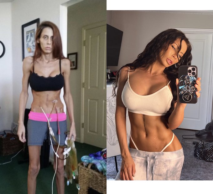 On this day every year I look back at how far I&rsquo;ve come. A reckless driver almost claimed my life and